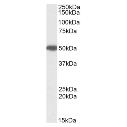 Western Blot - Anti-MON1A Antibody (A82602) - Antibodies.com