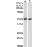 Western Blot - Anti-MON1A Antibody (A82602) - Antibodies.com