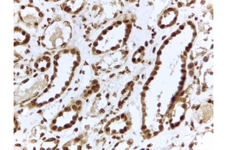 Immunohistochemistry - Anti-ILF3 Antibody (A82603) - Antibodies.com