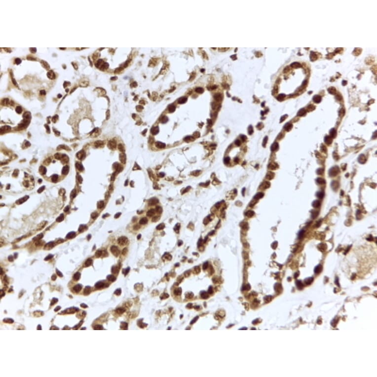 Immunohistochemistry - Anti-ILF3 Antibody (A82603) - Antibodies.com