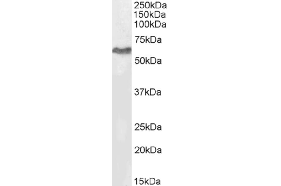 Western Blot - Anti-MURF2 Antibody (A82605) - Antibodies.com
