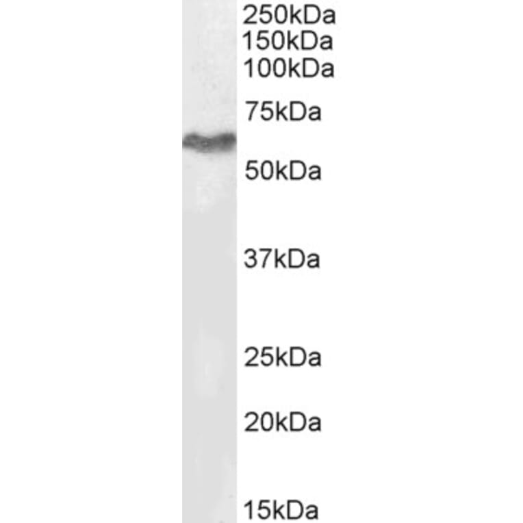 Western Blot - Anti-MURF2 Antibody (A82605) - Antibodies.com