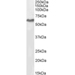 Western Blot - Anti-MURF2 Antibody (A82605) - Antibodies.com