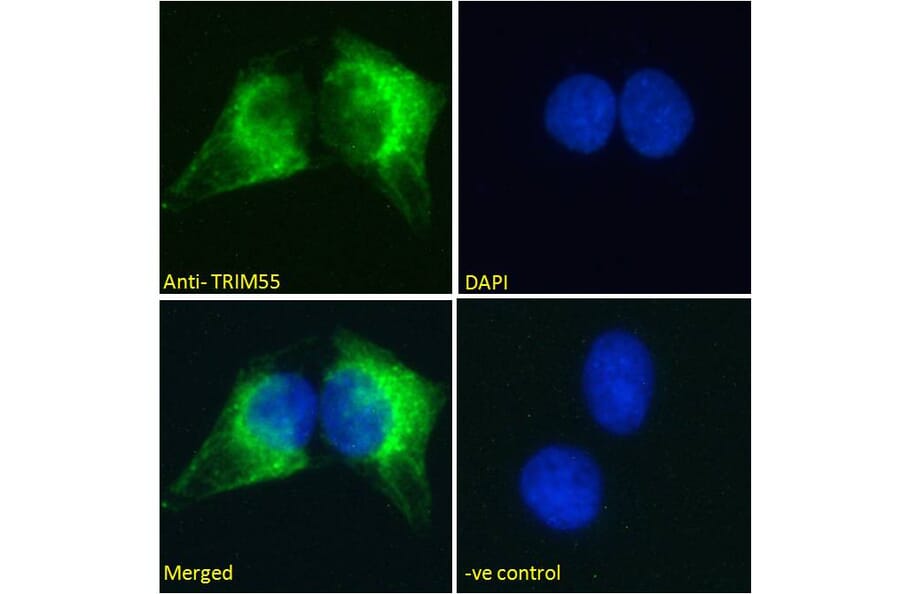 Immunofluorescence - Anti-MURF2 Antibody (A82605) - Antibodies.com