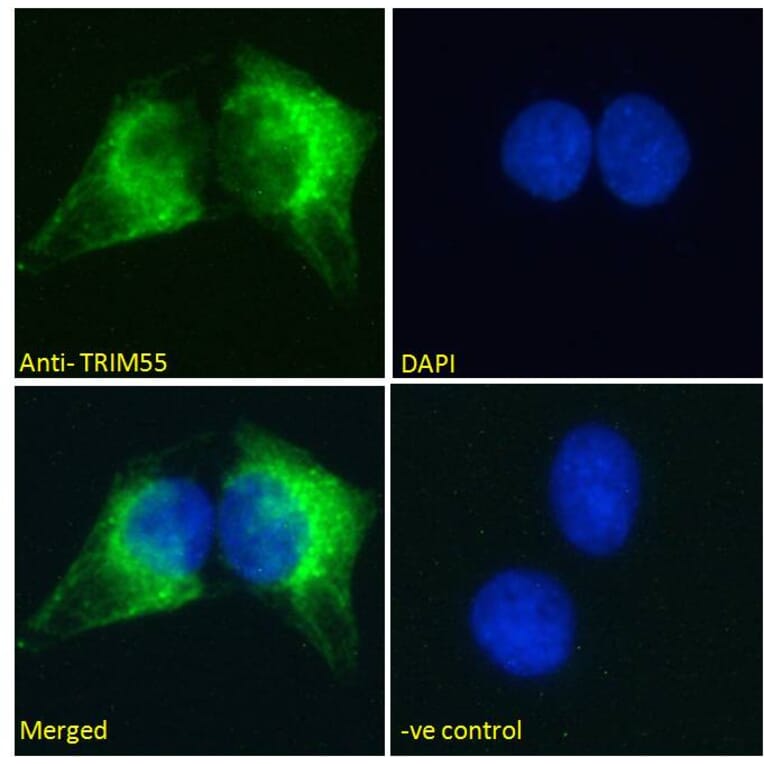 Immunofluorescence - Anti-MURF2 Antibody (A82605) - Antibodies.com