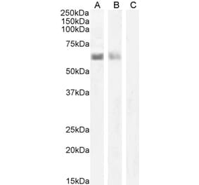 Western Blot - Anti-AIRE Antibody (A82607) - Antibodies.com