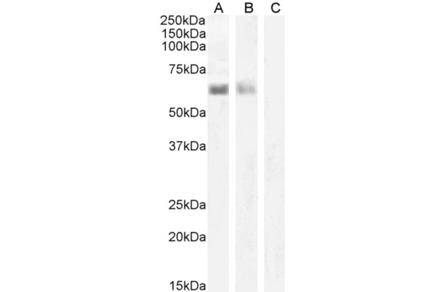 Western Blot - Anti-AIRE Antibody (A82607) - Antibodies.com