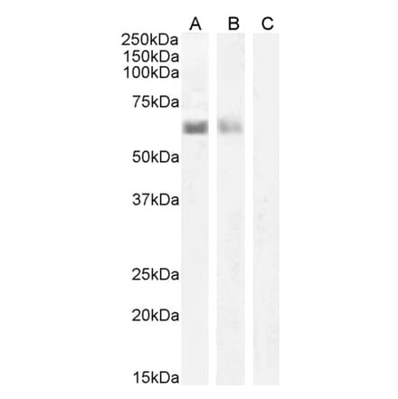 Western Blot - Anti-AIRE Antibody (A82607) - Antibodies.com