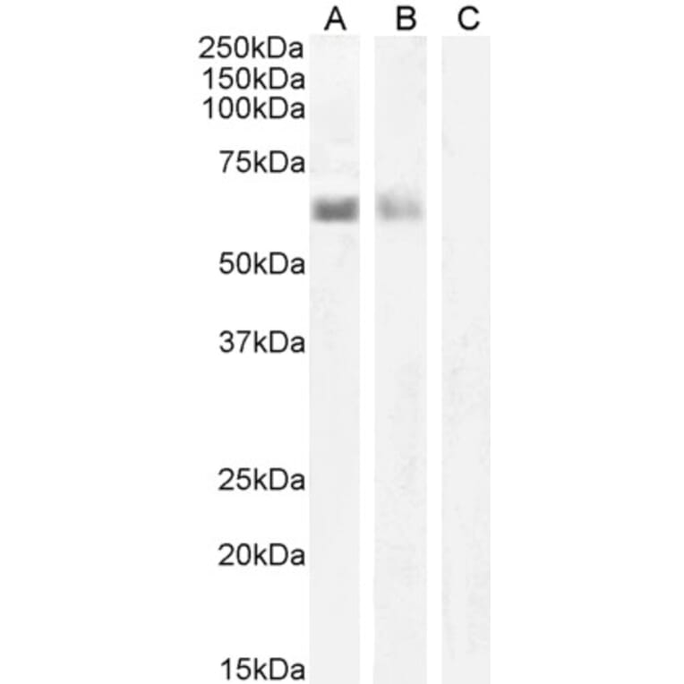 Western Blot - Anti-AIRE Antibody (A82607) - Antibodies.com