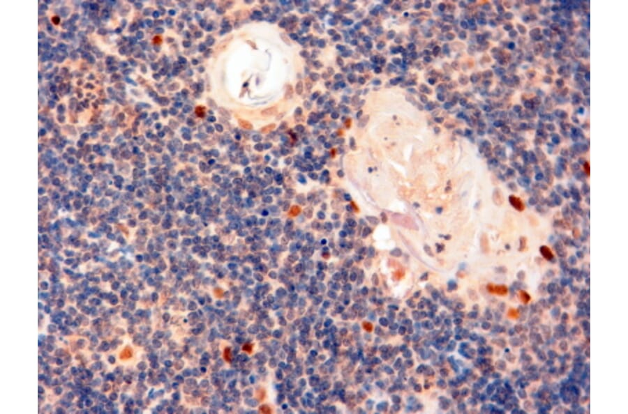 Immunohistochemistry - Anti-AIRE Antibody (A82607) - Antibodies.com