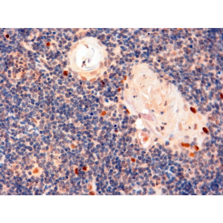 Immunohistochemistry - Anti-AIRE Antibody (A82607) - Antibodies.com
