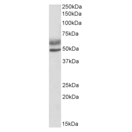 Western Blot - Anti-AIRE Antibody (A82607) - Antibodies.com