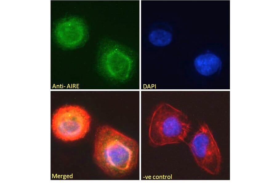 Immunofluorescence - Anti-AIRE Antibody (A82607) - Antibodies.com