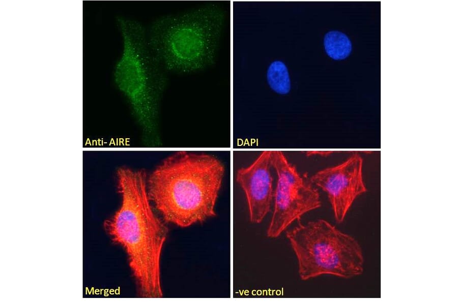 Immunofluorescence - Anti-AIRE Antibody (A82607) - Antibodies.com