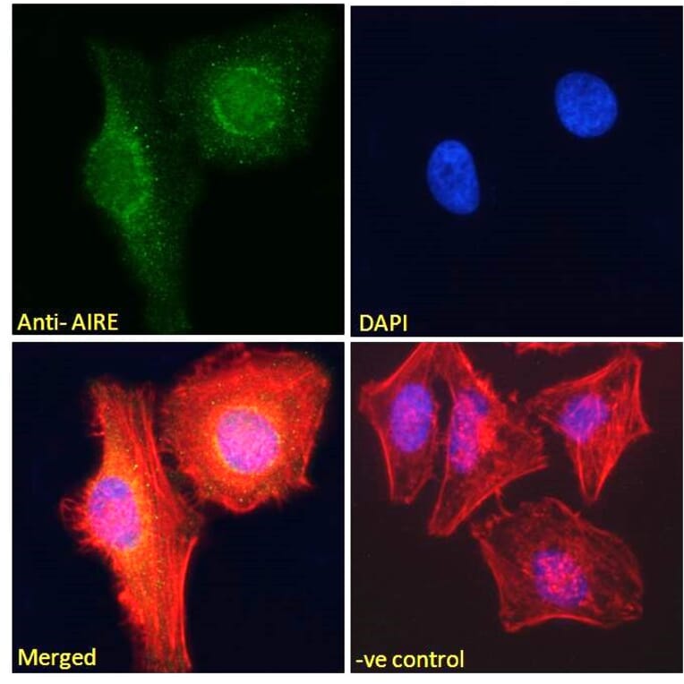 Immunofluorescence - Anti-AIRE Antibody (A82607) - Antibodies.com