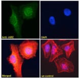 Immunofluorescence - Anti-AIRE Antibody (A82607) - Antibodies.com