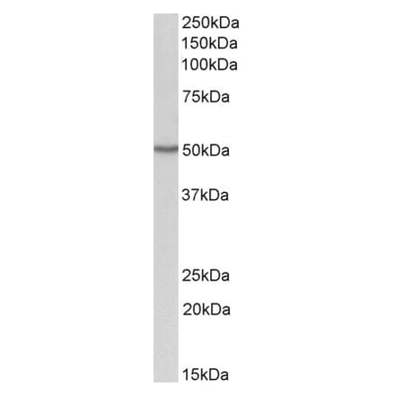 Western Blot - Anti-OAS1 Antibody (A82610) - Antibodies.com