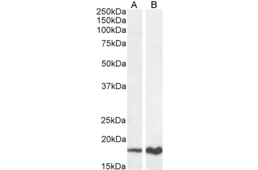 Western Blot - Anti-CDKN2A/p19ARF Antibody (A82613) - Antibodies.com