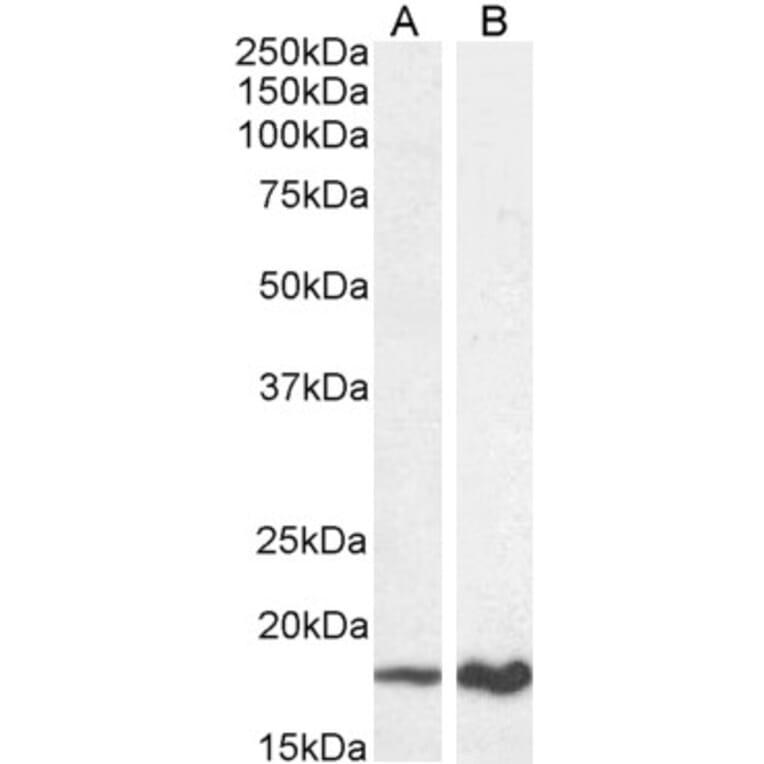 Western Blot - Anti-CDKN2A/p19ARF Antibody (A82613) - Antibodies.com