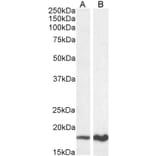 Western Blot - Anti-CDKN2A/p19ARF Antibody (A82613) - Antibodies.com