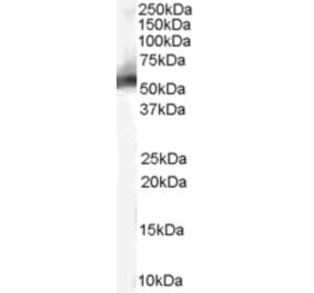 Western Blot - Anti-MDM2 Antibody (A82614) - Antibodies.com