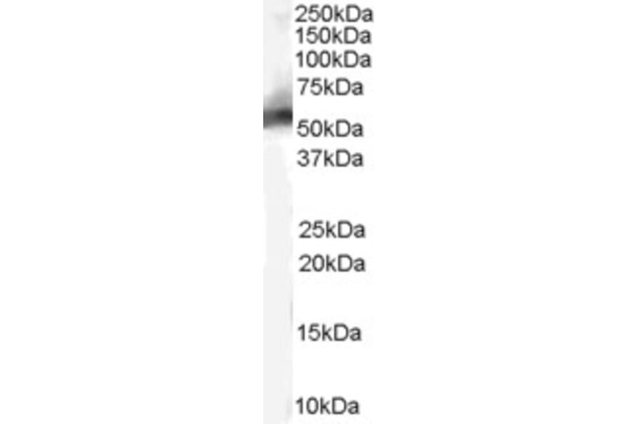 Western Blot - Anti-MDM2 Antibody (A82614) - Antibodies.com