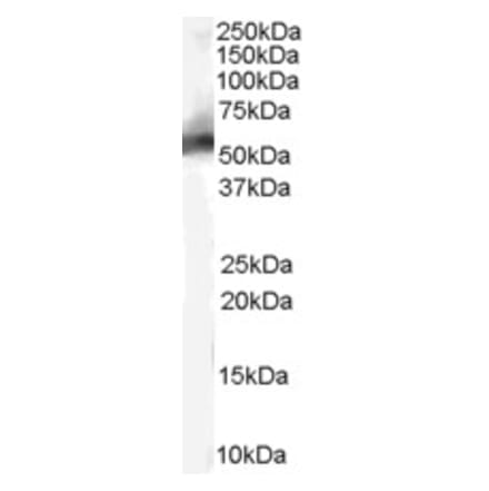 Western Blot - Anti-MDM2 Antibody (A82614) - Antibodies.com
