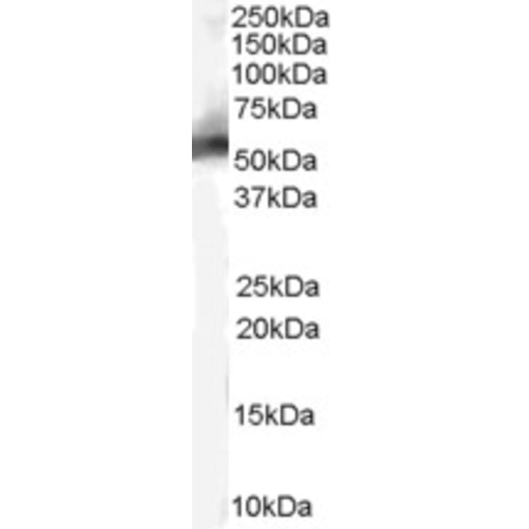 Western Blot - Anti-MDM2 Antibody (A82614) - Antibodies.com