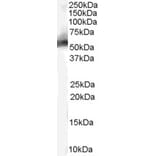 Western Blot - Anti-MDM2 Antibody (A82614) - Antibodies.com