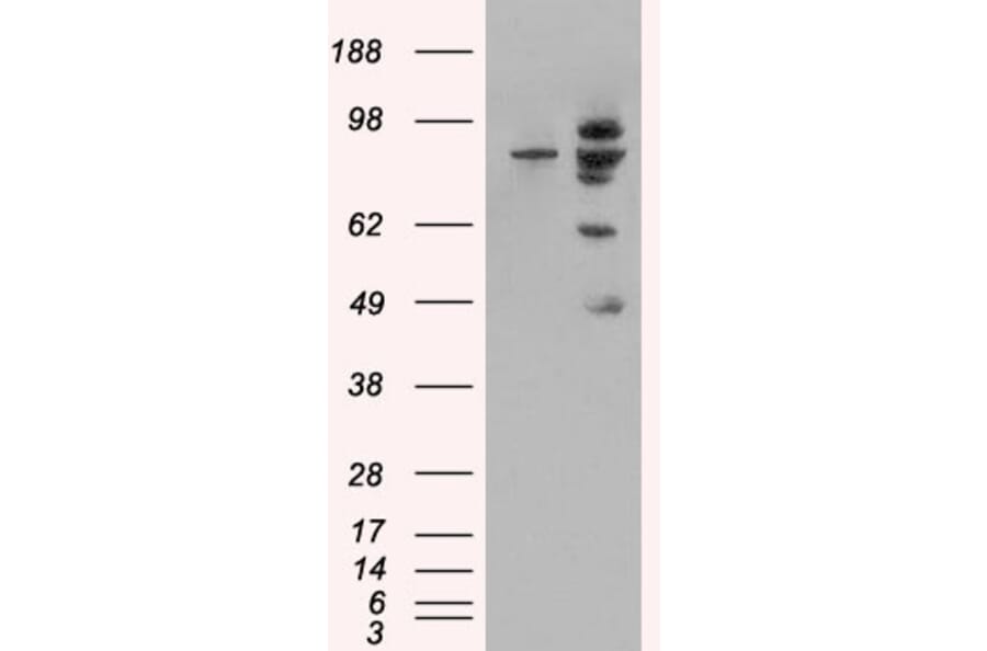 Western Blot - Anti-MDM2 Antibody (A82614) - Antibodies.com
