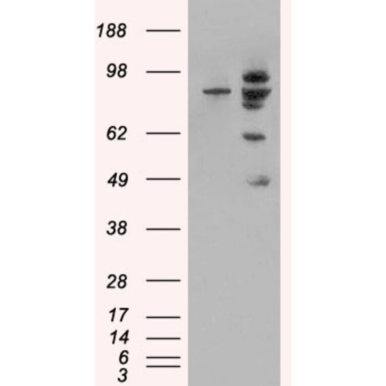 Western Blot - Anti-MDM2 Antibody (A82614) - Antibodies.com