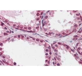 Immunohistochemistry - Anti-FOXP2 Antibody (A82615) - Antibodies.com