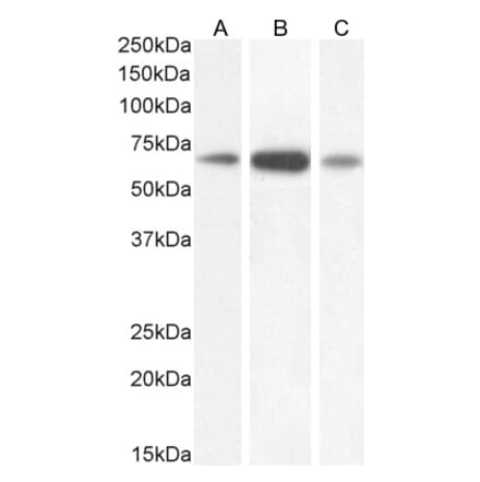 Western Blot - Anti-GAD67 Antibody (A82616) - Antibodies.com