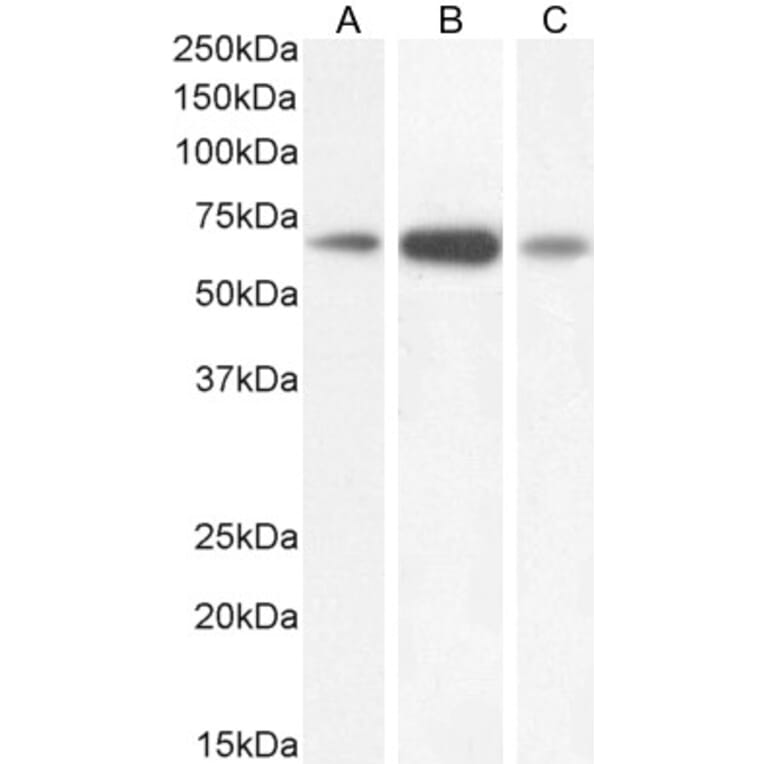 Western Blot - Anti-GAD67 Antibody (A82616) - Antibodies.com
