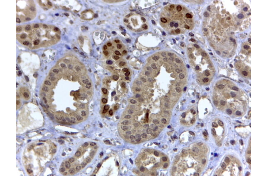Immunohistochemistry - Anti-HIF3 alpha/IPAS Antibody (A82617) - Antibodies.com