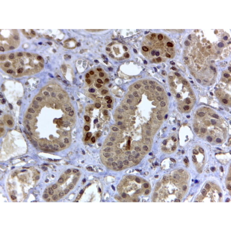 Immunohistochemistry - Anti-HIF3 alpha/IPAS Antibody (A82617) - Antibodies.com