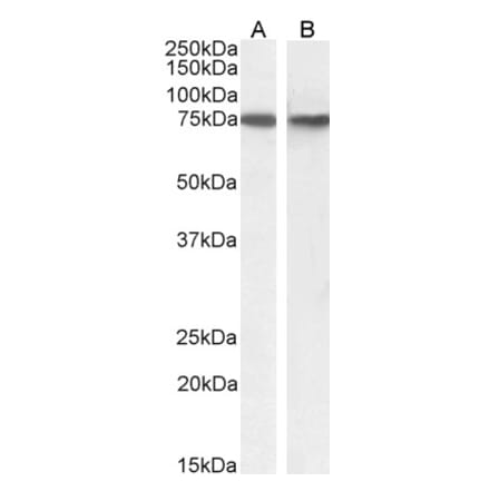 Western Blot - Anti-SNX1 Antibody (A82618) - Antibodies.com