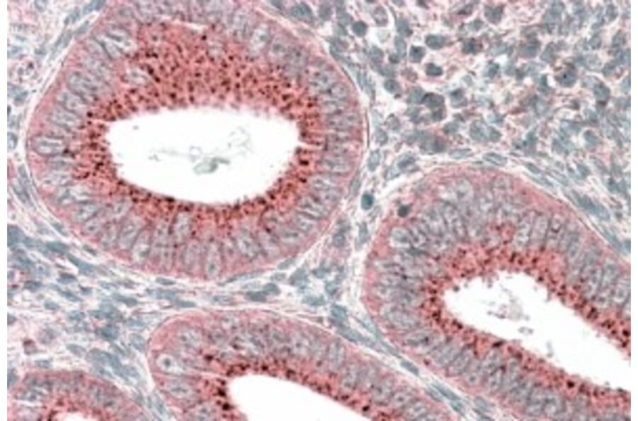 Immunohistochemistry - Anti-SNX1 Antibody (A82618) - Antibodies.com