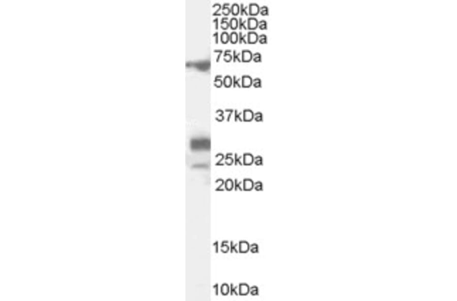 Western Blot - Anti-Sall4 Antibody (A82620) - Antibodies.com