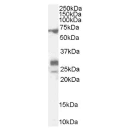 Western Blot - Anti-Sall4 Antibody (A82620) - Antibodies.com