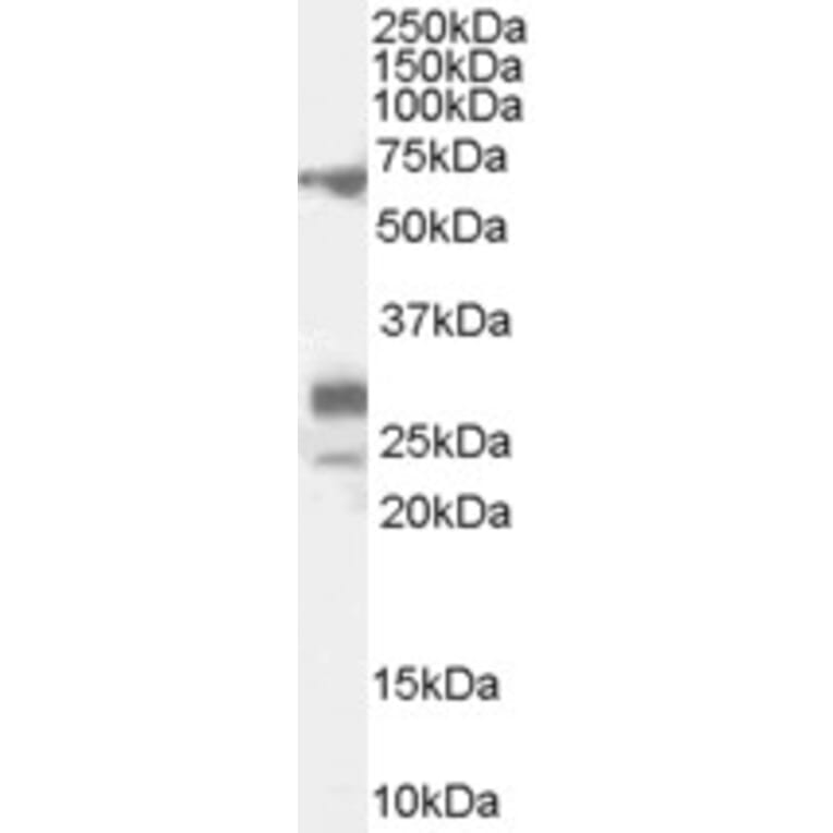 Western Blot - Anti-Sall4 Antibody (A82620) - Antibodies.com