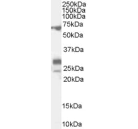 Western Blot - Anti-Sall4 Antibody (A82620) - Antibodies.com
