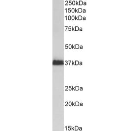 Western Blot - Anti-MSI2 Antibody (A82621) - Antibodies.com