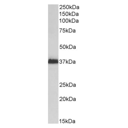 Western Blot - Anti-MSI2 Antibody (A82621) - Antibodies.com