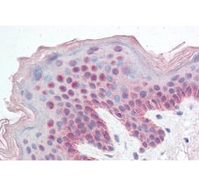 Immunohistochemistry - Anti-KDM2B Antibody (A82622) - Antibodies.com