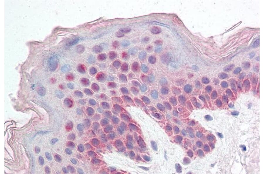Immunohistochemistry - Anti-KDM2B Antibody (A82622) - Antibodies.com