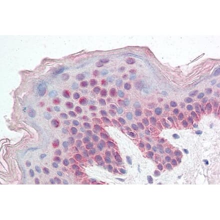 Immunohistochemistry - Anti-KDM2B Antibody (A82622) - Antibodies.com