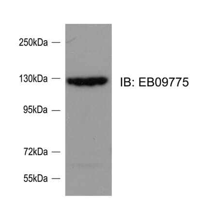 Western Blot - Anti-srGAP2 Antibody (A82623) - Antibodies.com