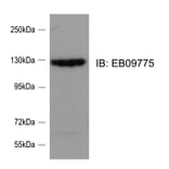 Western Blot - Anti-srGAP2 Antibody (A82623) - Antibodies.com