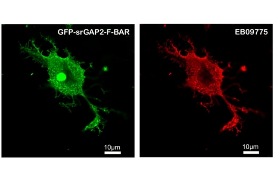 Immunofluorescence - Anti-srGAP2 Antibody (A82623) - Antibodies.com